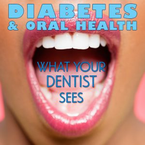 Dental_and_Diabetes