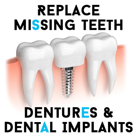 Dentures_Implants (1)