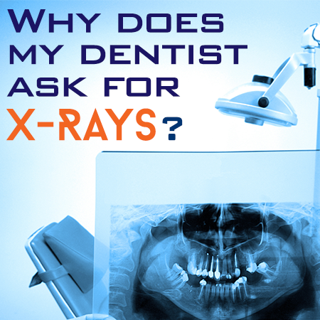 X Rays