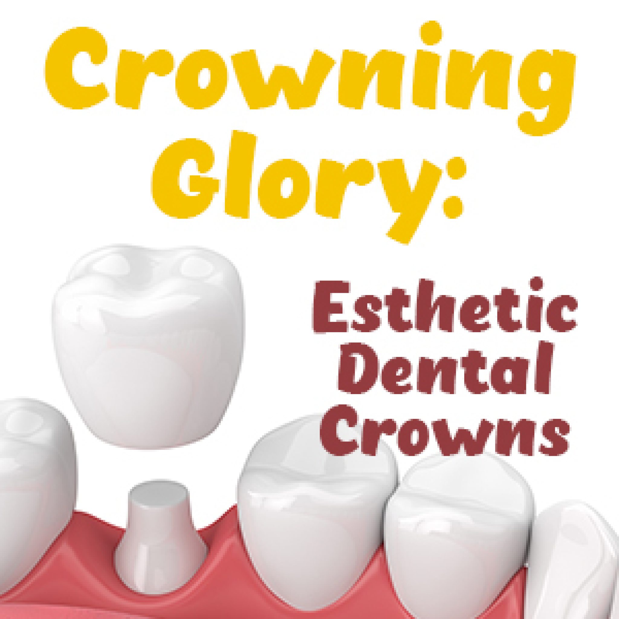 Different Types of Dental Crowns Granbury Dental Center