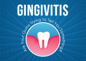 Granbury dentists at Granbury Dental Center tell patients about gingivitis—causes, symptoms, and treatments to help get your gums healthy.