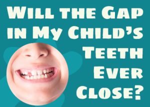 Granbury dentist Dr. Jeff Buske of Granbury Dental Center talks about potential causes and treatments for gapped teeth in children.