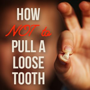 Granbury Dental Center give tips on how to handle a loose tooth