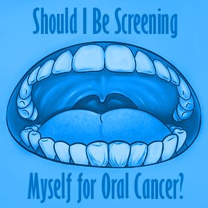 Should I be screening myself for oral cancer?
