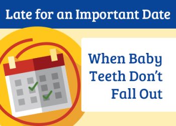 Granbury dentist, Dr. Buske at Granbury Dental Center, discusses the causes and treatment options of over-retained baby teeth that don’t come out naturally on their own.