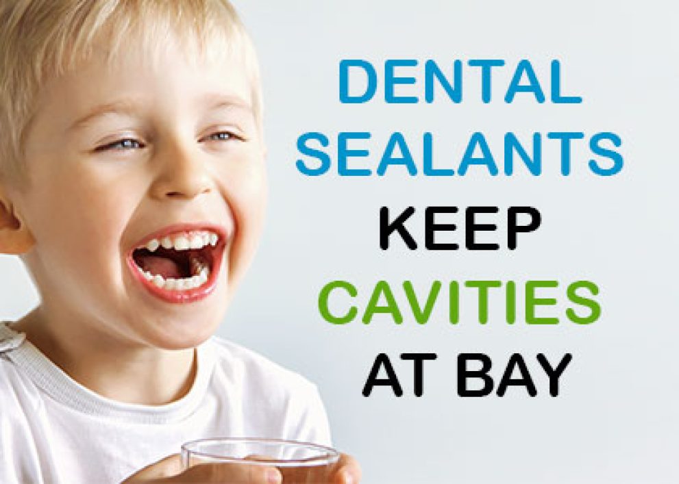 Dental Sealants for Kids in Granbury Granbury Dental Center