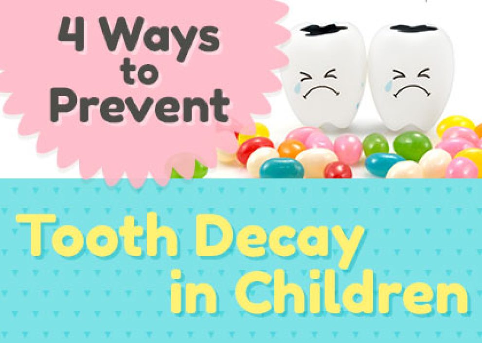 4 Ways to Prevent Tooth Decay in Children Granbury Dental Center