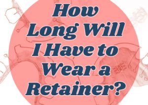 Granbury dentists at Granbury Dental Center discusses how long a retainer should be worn after orthodontic treatment.