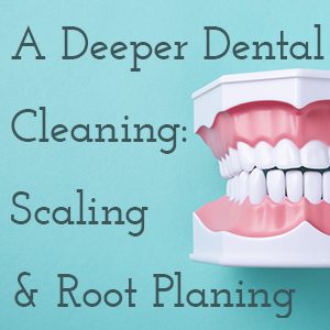 Granbury dentists, Drs. Buske, Okada, Grammer, & Baird at Granbury Dental Center tell patients about what scaling and root planing is and why it might be part of your treatment plan.