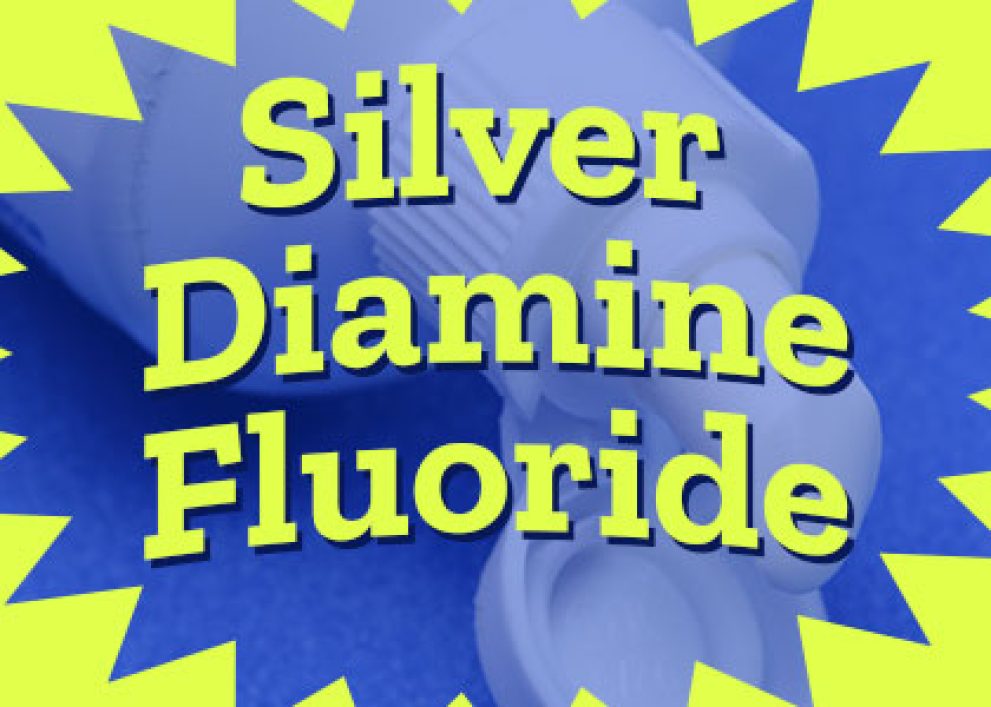 Silver Diamine Fluoride in Granbury, TX ǀ Granbury Dental Center