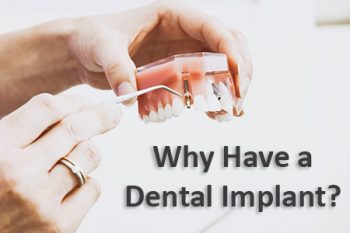 Granbury dentist, Dr. Buske at Granbury Dental Center, discusses dental implants and why they might be a good choice for you.