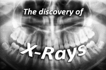 Granbury dentist, Dr. Buske at Granbury Dental Center, discusses the discovery of X-rays and how they have advanced over the years.