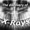 The Discovery of X-Rays (featured image)